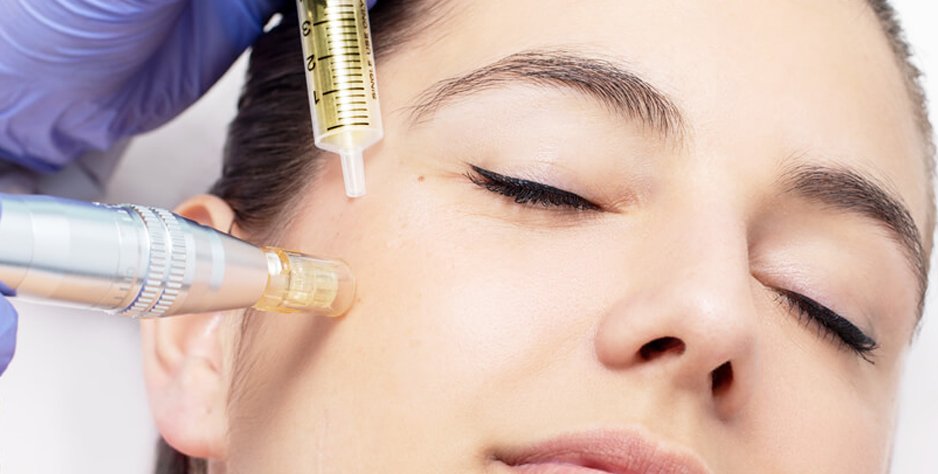 botox dubai