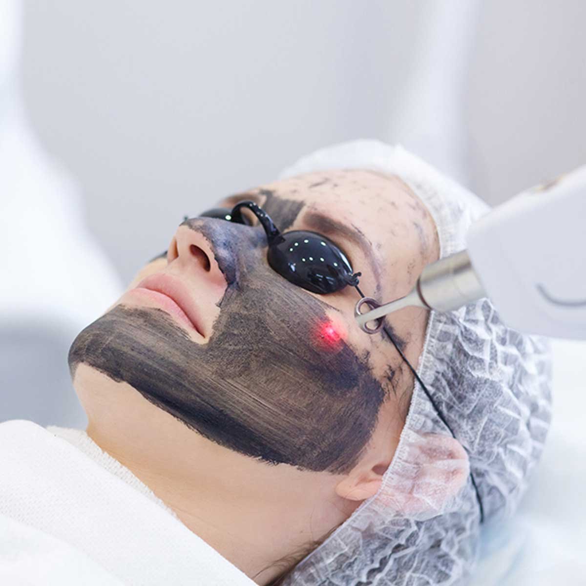 Microneedling Salmon DNA