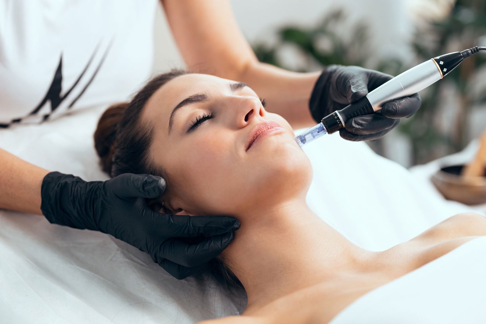 Microneedling Salmon DNA