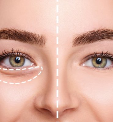 Dr. Omar Al Khalili Clinic dermatology , aesthetics and beauty